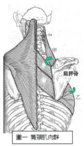 neckback