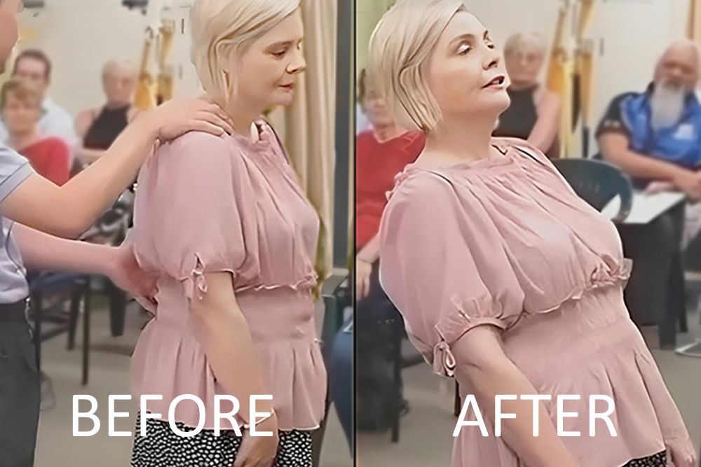 PFP Before & After Physiotherapy
