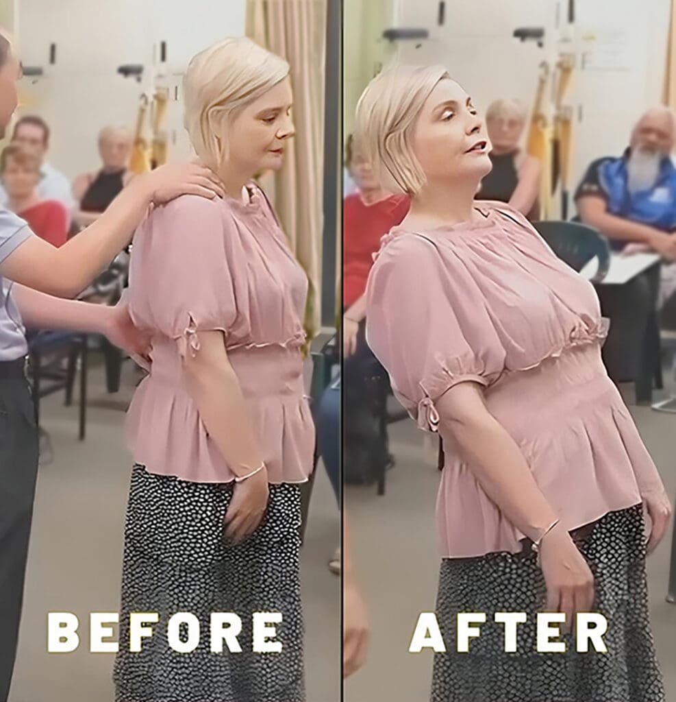 Back before and after Pain Free Physio