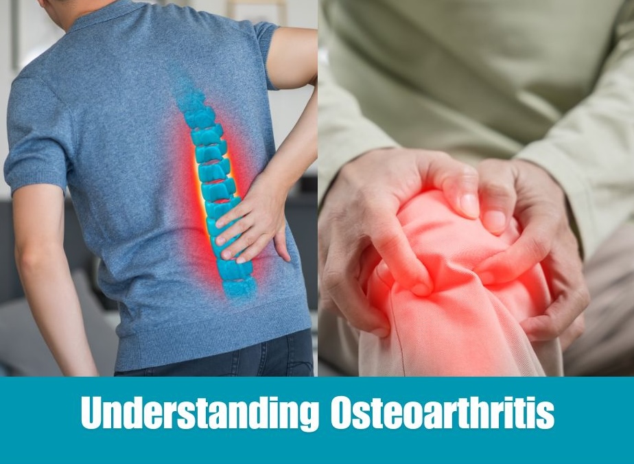 Understanding Osteoarthritis